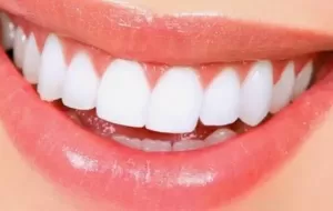 How To Whiten Teeth Naturally