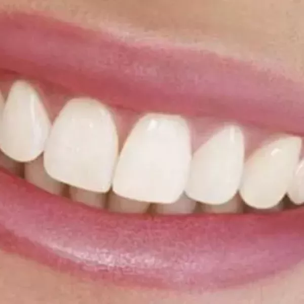How Do We Maintain Our Teeth? How Do We Maintain Our Teeth?
