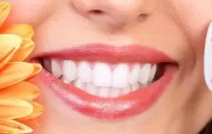 How To Get Rid Of Tooth Yellowing