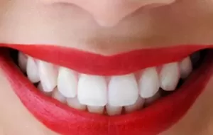 How To Whiten Teeth