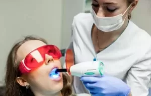 How Long Does Laser Teeth Whitening Last?