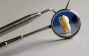 Dental Crown Method